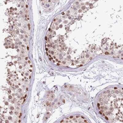 Immunohistochemistry-Paraffin: BARD1 Antibody [NBP2-47543] - Staining of human testis shows high expression.