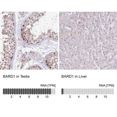 Immunohistochemistry-Paraffin: BARD1 Antibody [NBP2-47543] - Staining in human testis and liver tissues using anti-BARD1 antibody. Corresponding BARD1 RNA-seq data are presented for the same tissues.