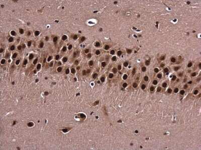 Immunohistochemistry-Paraffin: BARD1 Antibody [NBP3-13065] - BARD1 antibody detects BARD1 protein at nucleus in mouse brain by immunohistochemical analysis. Sample: Paraffin-embedded mouse brain. BARD1 antibody (NBP3-13065) diluted at 1:400. Antigen Retrieval: Citrate buffer, pH 6.0, 15 min