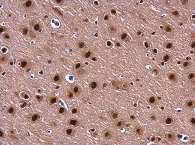 Immunohistochemistry-Paraffin: BARD1 Antibody [NBP3-13065] - BARD1 antibody detects BARD1 protein at nucleus in rat brain by immunohistochemical analysis. Sample: Paraffin-embedded rat brain. BARD1 antibody (NBP3-13065) diluted at 1:400. Antigen Retrieval: Citrate buffer, pH 6.0, 15 min