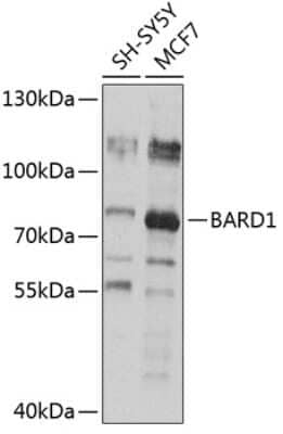 Western Blot: BARD1 Antibody [NBP2-92343] - Analysis of extracts of various cell lines, using BARD1 at 1:1000 dilution.Secondary antibody: HRP Goat Anti-Rabbit IgG (H+L) at 1:10000 dilution.Lysates/proteins: 25ug per lane.Blocking buffer: 3% nonfat dry milk in TBST.Detection: ECL Basic Kit .Exposure time: 30s.