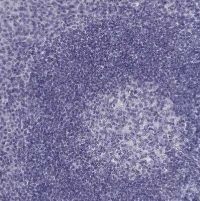 Immunohistochemistry-Paraffin: BARHL1 Antibody [NBP1-86513] - Staining of human tonsil shows no positivity in non-germinal center cells as expected.