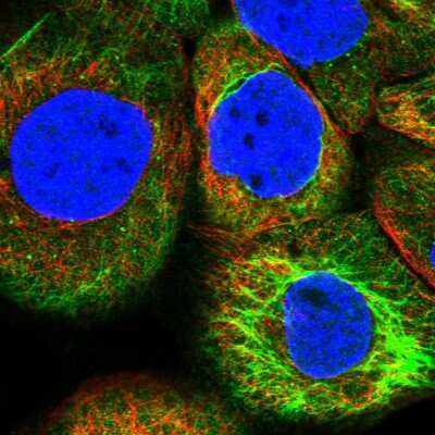 Immunocytochemistry/Immunofluorescence: BASC4 Antibody [NBP1-85524] - Immunofluorescent staining of human cell line A-431 shows localization to cytosol & intermediate filaments. Antibody staining is shown in green. 