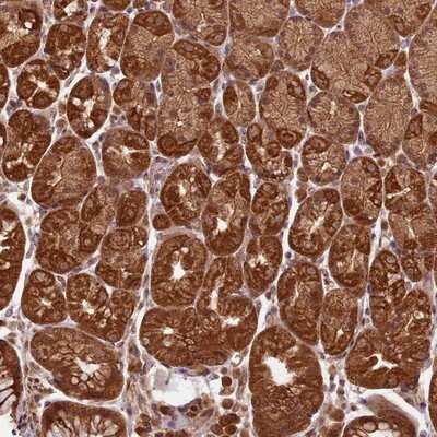 Immunohistochemistry-Paraffin: BASC4 Antibody [NBP1-85524] - Staining of human stomach, lower shows strong cytoplasmic positivity in glandular cells.