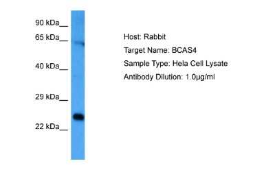 Western Blot: BASC4 Antibody [NBP2-84498] - Host: Rabbit. Target Name: BCAS4. Sample Tissue: Human Hela Whole Cell. Antibody Dilution: 1.0ug/ml