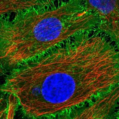 Immunocytochemistry/Immunofluorescence: BASP1 Antibody [NBP2-58332] - Staining of human cell line HeLa shows localization to plasma membrane.