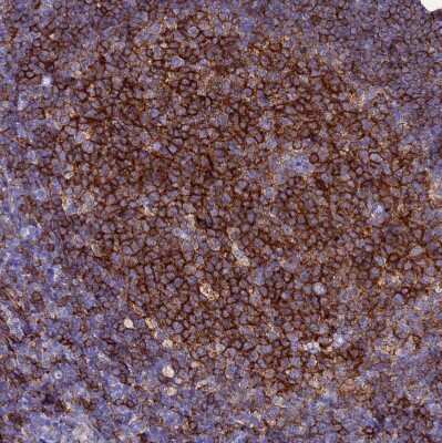 Immunohistochemistry-Paraffin: BASP1 Antibody [NBP2-14347] - Staining of human tonsil shows strong membranous positivity in germinal center cells.