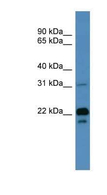 Western Blot: BASP1 Antibody [NBP1-68958] - Human Muscle lysate, concentration 0.125ug/ml.