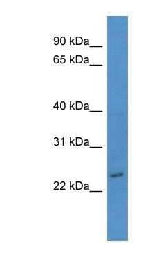 Western Blot: BASP1 Antibody [NBP1-68985] - Titration: 0.2-1 ug/ml, Positive Control: Jurkat cell lysate.