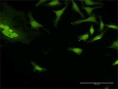 Immunocytochemistry/Immunofluorescence: BAT3/BAG6 Antibody [H00007917-D01P] - Analysis of antibody to BAT3 on HeLa cell. Antibody concentration 30 ug/ml.