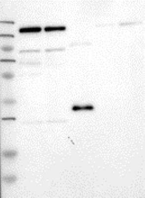 Western Blot: BAT3/BAG6 Antibody [30230002] - Samples:  Lane 1, Marker [kDa]: 250, 130, 95, 72, 55, 36, 28, 17, 11  Lane 2, RT-4  Lane 3, U-251MG sp  Lane 4, Human Plasma  Lane 5, Liver  Lane 6, Tonsil , Target weight [kDa]:  119    Validation score:  2   Validation description:  Supportive - Band of predicted size in kDa (+/-20%) with additional bands present.