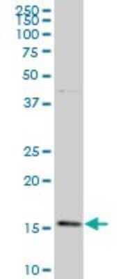 Western Blot: BATF Antibody (1G4) [H00010538-M03] - Analysis of BATF expression in Hela S3 NE (Cat # L013V3).