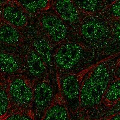 Immunocytochemistry/Immunofluorescence: BATF Antibody [NBP2-49431] - Immunofluorescent staining of human cell line RT4 shows localization to nucleoplasm. Antibody staining is shown in green.