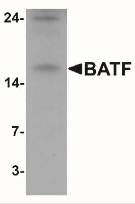Western Blot: BATF Antibody [NBP2-41191] - Western blot analysis of BATF in rat spleen tissue lysate with BATF antibody at 1 ug/mL.