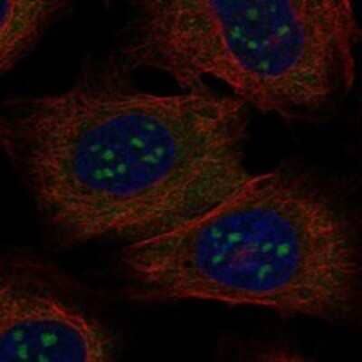 Immunocytochemistry/Immunofluorescence: BATF3 Antibody [NBP3-17688] - Staining of human cell line U-2 OS shows localization to nucleoli & cytosol.