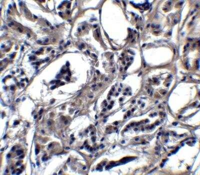 Immunohistochemistry BATF3 Antibody - BSA Free