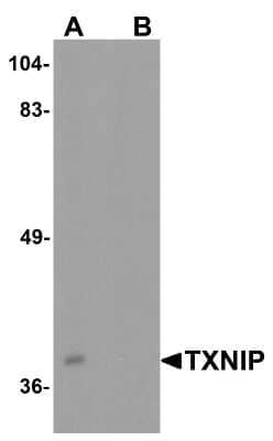 Western Blot BATF3 Antibody - BSA Free