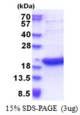 SDS-PAGE Recombinant Human BATF3 His Protein