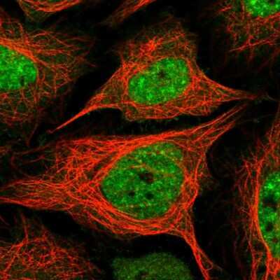 Immunocytochemistry/Immunofluorescence: BAZ2A Antibody [NBP2-55854] - Staining of human cell line SiHa shows localization to nuclear speckles. Antibody staining is shown in green.