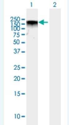 Western Blot: BAZ2A Antibody [H00011176-B01P-50ug] - Analysis of BAZ2A expression in transfected 293T cell line (H00011176-T01) by BAZ2A MaxPab polyclonal antibody.  Lane 1: BAZ2A transfected lysate(209.55 KDa). Lane 2: Non-transfected lysate.