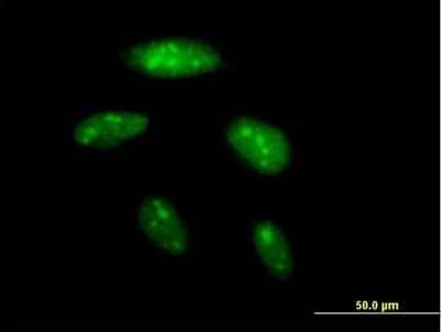 Immunocytochemistry/Immunofluorescence: BAZ2B Antibody [H00029994-B01P] - Analysis of purified antibody to BAZ2B on HeLa cell. (antibody concentration 10 ug/ml)