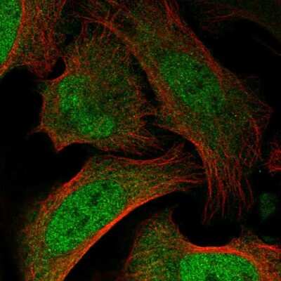 Immunocytochemistry/Immunofluorescence: BAZ2B Antibody [NBP2-57156] - Staining of human cell line U-2 OS shows localization to nucleoplasm & cytosol. Antibody staining is shown in green.