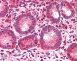 Immunohistochemistry-Paraffin: BAZ2B Antibody [NB100-1155] - IHC analysis of BAZ2B in paraffin embedded Human Small Intestine using this antibody at 5 ug/ml. Steamed antigen retrieval with citrate buffer pH 6, AP-staining.
