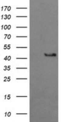 Western Blot: BBOX1 Antibody (OTI4F9) - Azide and BSA Free [NBP2-71372] - Analysis of HEK293T cells were transfected with the pCMV6-ENTRY control (Left lane) or pCMV6-ENTRY BBOX1.