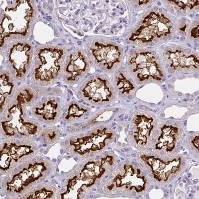Immunohistochemistry BBS12 Antibody - BSA Free