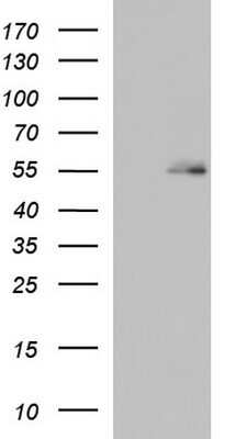 Western Blot: BBS4 Antibody (OTI2D5) - Azide and BSA Free [NBP2-70241] - Analysis of HEK293T cells were transfected with the pCMV6-ENTRY control (Left lane) or pCMV6-ENTRY BBS4 .