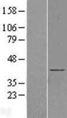 Western Blot: BBS5 Overexpression Lysate (Adult Normal) [NBL1-07930] Left-Empty vector transfected control cell lysate (HEK293 cell lysate); Right -Over-expression Lysate for BBS5.