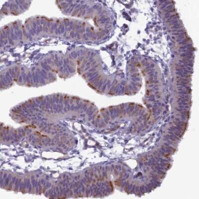 Immunohistochemistry-Paraffin: BBS7 Antibody [NBP1-88690] - Staining of human fallopian tube shows moderate membranous positivity in glandular cells.