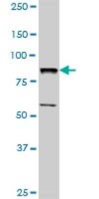 Western Blot: BBS7 Antibody [H00055212-D01P] - Analysis of BBS7 expression in A-431.