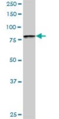 Western Blot: BBS7 Antibody [H00055212-D01P] - Analysis of BBS7 expression in mouse lung.