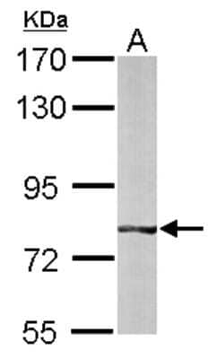 Western Blot: BBS7 Antibody [NBP1-32754] - Sample (50 ug of whole cell lysate) A: mouse liver 7. 5% SDS PAGE; antibody diluted at 1:1000.