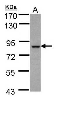 Western Blot: BBS7 Antibody [NBP1-32754] - Sample (30 ug of whole cell lysate) A: A431 7.5% SDS PAGE, antibody diluted at 1:1000.