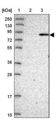 Western Blot: BBS7 Antibody [NBP1-88690] - Lane 1: Marker  [kDa] 250, 130, 95, 72, 55, 36, 28, 17, 10.  Lane 2: Human cell line RT-4.  Lane 3: Human cell line U-251MG sp