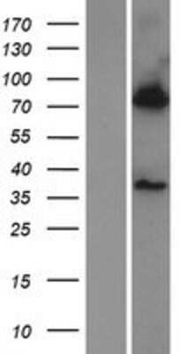 Western Blot: BBS7 Overexpression Lysate (Adult Normal) [NBP2-06854] Left-Empty vector transfected control cell lysate (HEK293 cell lysate); Right -Over-expression Lysate for BBS7.