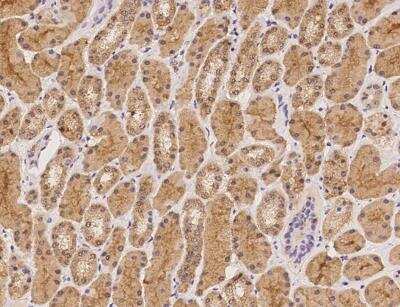 Immunohistochemistry-Paraffin: BBS9 Antibody [NBP3-12584] -  Staining of human BBS9 in human kidney with rabbit polyclonal antibody at 1:100 dilution.