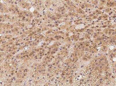 Immunohistochemistry-Paraffin: BBS9 Antibody [NBP3-12584] -  Staining of human BBS9 in human adrenal gland with rabbit polyclonal antibody at 1:100 dilution.