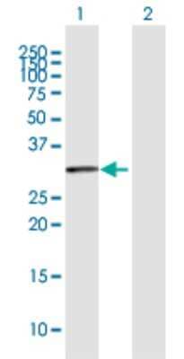 Western Blot: BBS9 Antibody [H00027241-D02P] - Analysis of BBS9 expression in transfected 293T cell line by BBS9 polyclonal antibody.Lane 1: BBS9 transfected lysate(34.80 KDa).Lane 2: Non-transfected lysate.