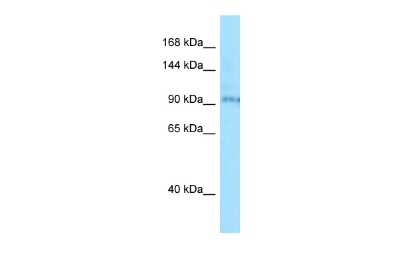 Western Blot: BBS9 Antibody [NBP2-84499] - WB Suggested Anti-BBS9 Antibody. Titration: 1.0 ug/ml. Positive Control: Jurkat Whole Cell