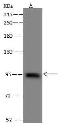 Western Blot: BBS9 Antibody [NBP3-12584] - Lane A: U-251 MG Whole Cell LysateLysates/proteins at 30 ug per lane.SecondaryGoat Anti-Rabbit IgG (H+L)/HRP at 1/10000 dilution.Developed using the ECL technique.Performed under reducing conditions.Predicted band size:95 kDaObserved band size:95 kDa