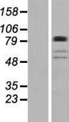 Western Blot: BBS9 Overexpression Lysate (Adult Normal) [NBP2-04684] Left-Empty vector transfected control cell lysate (HEK293 cell lysate); Right -Over-expression Lysate for BBS9.