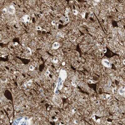 Immunohistochemistry-Paraffin: BBX Antibody [NBP2-47542] - Staining of human cerebral cortex shows strong cytoplasmic and nuclear positivity in neurons.