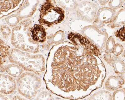 Immunohistochemistry-Paraffin: BCAM/CD239 Antibody (JE51-07) [NBP2-80450] - Analysis in human kidney tissue using BCAM/BCAM/CD239 antibody. The section was pre-treated using heat mediated antigen retrieval with Tris-EDTA buffer (pH 8.0-8.4) for 20 minutes. The tissues were blocked in 5% BSA for 30 minutes at room temperature, was