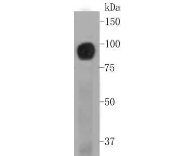 Western Blot: BCAM/CD239 Antibody (JE51-07) [NBP2-80450] - Analysis of BCAM/CD239 on A431 cell lysate. Proteins were transferred to a PVDF membrane and blocked with 5% BSA in PBS for 1 hour at room temperature. The primary antibody (NBP2-80450, 1/500) was used in 5% BSA at room temperature for 2 hours. Goat Anti-Rabbit IgG - HRP Secondary Antibody at 1:5,000 dilution was used for 1 hour at room temperature.