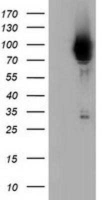 Flow Cytometry: BCAP/PIK3AP1 Antibody (OTI7A11) - Azide and BSA Free [NBP2-72368] - HEK293T cells were transfected with the pCMV6-ENTRY control (Left lane) or pCMV6-ENTRY PIK3AP1 (Right lane) cDNA for 48 hrs and lysed. Equivalent amounts of cell lysates (5 ug per lane) were separated by SDS-PAGE and immunoblotted with anti-PIK3AP1.