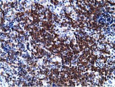 Immunohistochemistry: BCAP/PIK3AP1 Antibody (OTI7A11) - Azide and BSA Free [NBP2-72368] - Staining of paraffin-embedded Human lymphoma tissue using anti-PIK3AP1 mouse monoclonal antibody.