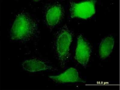 Immunocytochemistry/Immunofluorescence: BCAP31 Antibody [H00010134-B01P] - Analysis of purified antibody to BCAP31 on HeLa cell. (antibody concentration 10 ug/ml)